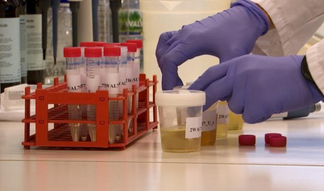 Biomonitoring Humain : plomb et pesticides dans le corps des wallons