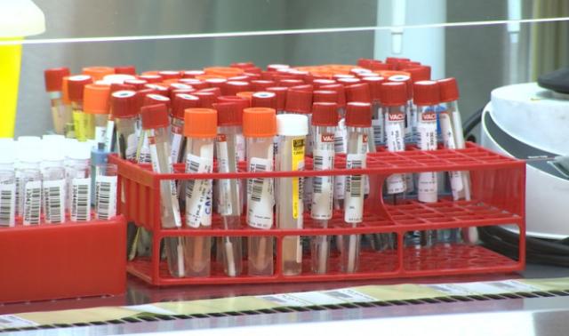 Dépistage de la Covid-19 : les laboratoires hospitaliers sont débordés