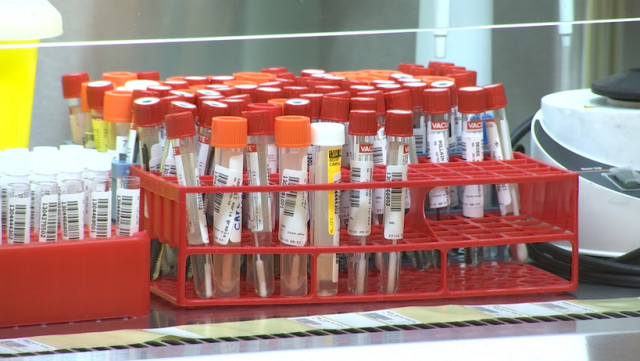 Dépistage de la Covid-19 : les laboratoires hospitaliers sont débordés