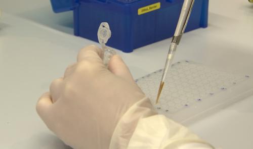 Évolution du virus: premiers résultats du séquençage liégeois