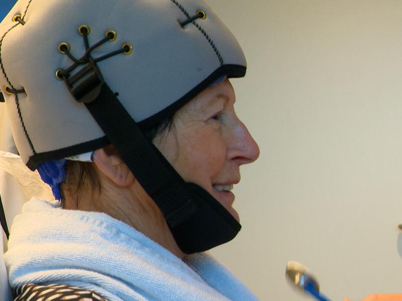 Conserver ses cheveux durant la chimiothérapie