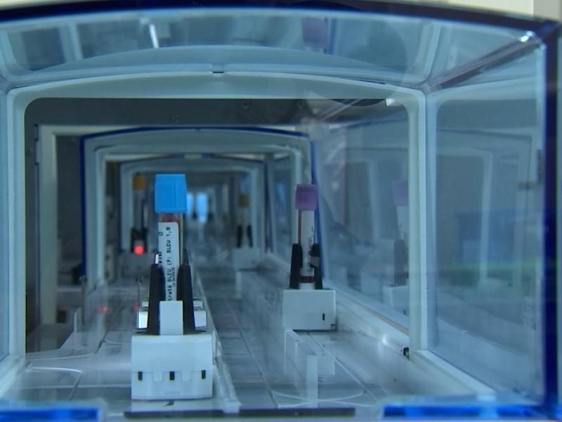 Cancer du sein : une prise de sang pour détecter les premiers signes d'une rechute ?