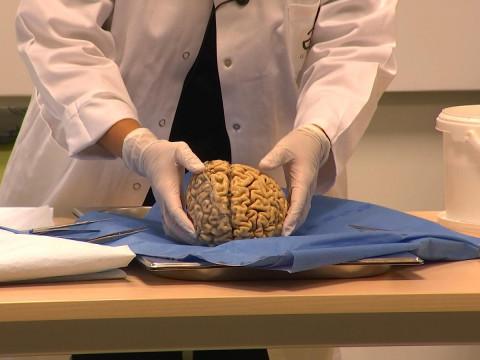 Ils assistent à une dissection d'un cerveau ! 
