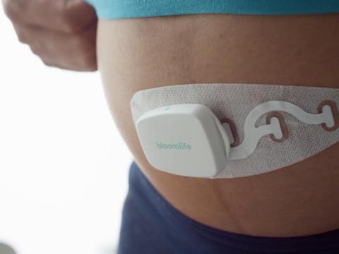 Bloomlife et son monitoring de grossesse, récompensé à Las Vegas !