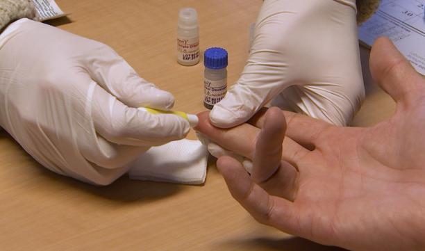 Sida Sol: baisse des dépistages suite au Covid