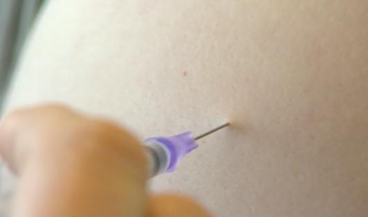 Le deuxième vaccin entre en action à la Clinique André Renard