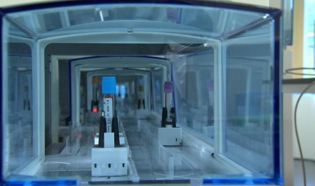 Cancer du sein : une prise de sang pour détecter les premiers signes d'une rechute ?