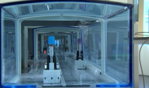 Cancer du sein : une prise de sang pour détecter les premiers signes d'une rechute ?