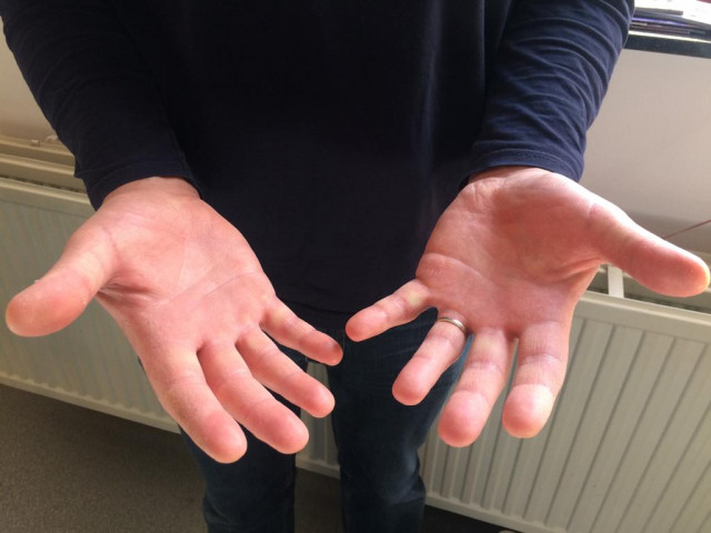 Préserver ses mains face à la crise du Covid-19