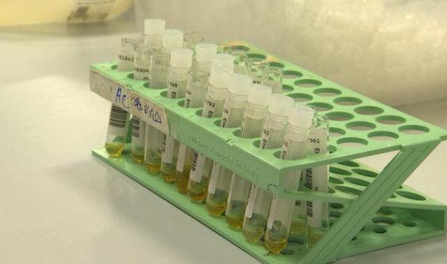Test PCR ou sérologique, quelles sont les différences?