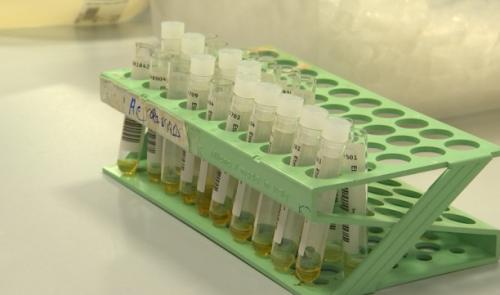 Test PCR ou sérologique, quelles sont les différences?