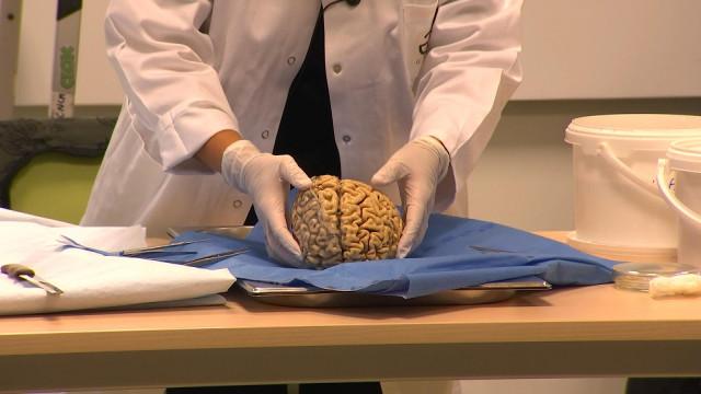Ils assistent à une dissection d'un cerveau ! 