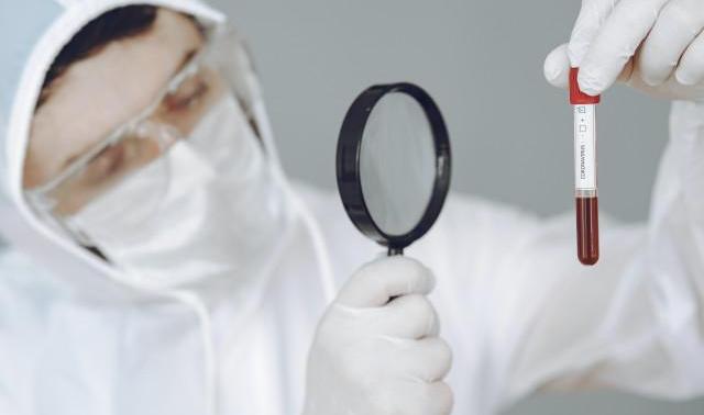 Covid-19 : une solution pour réduire le taux de mortalité en cas de détresse respiratoire
