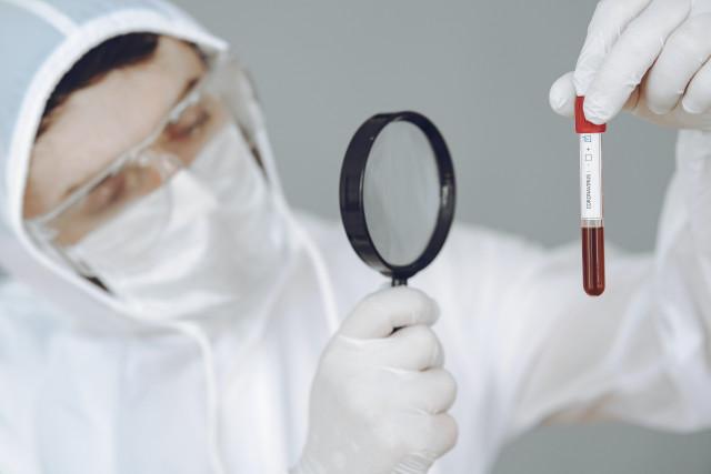 Covid-19 : une solution pour réduire le taux de mortalité en cas de détresse respiratoire