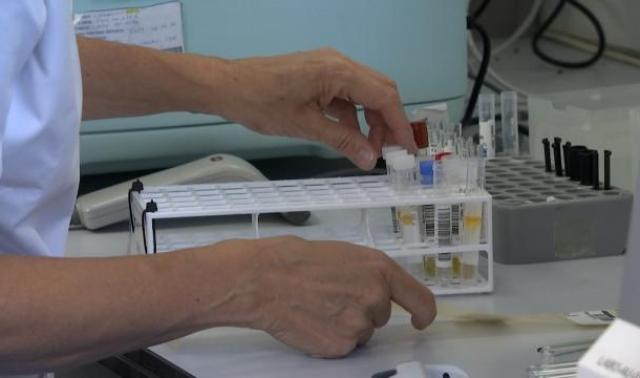330 cas de variole du singe en Belgique: des spécialistes liégeois rassurent