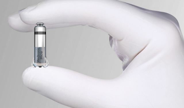 CHR : le plus petit stimulateur cardiaque au monde implanté avec succès 