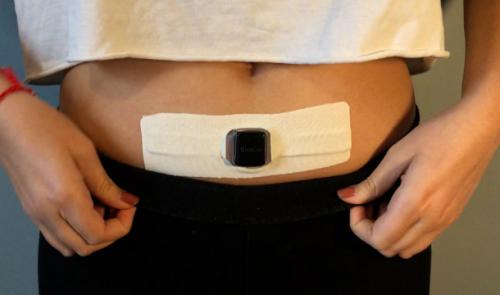 La ceinture de la société liégeoise Alvalux pour aider à résorber les cicatrices 
