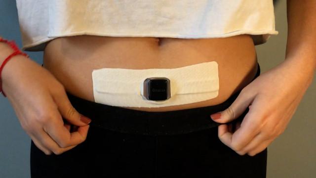 La ceinture de la société liégeoise Alvalux pour aider à résorber les cicatrices 