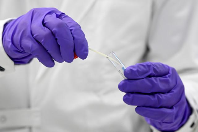 Le Labo Cita à Liège réduit ses heures d'ouverture faute de réactifs en suffisance